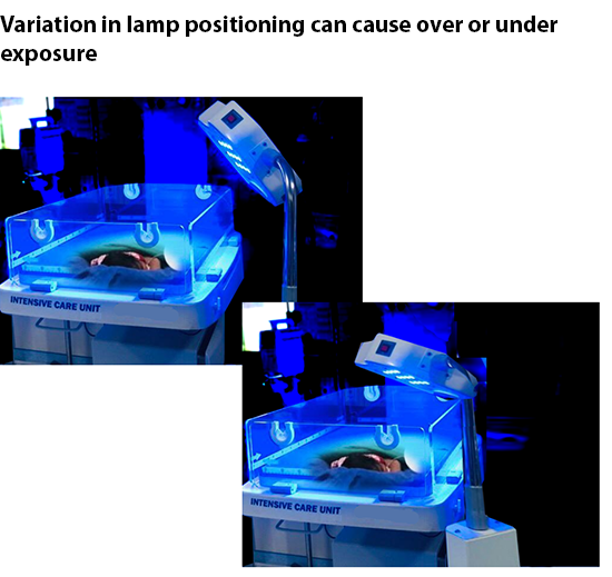 Lamp positioning